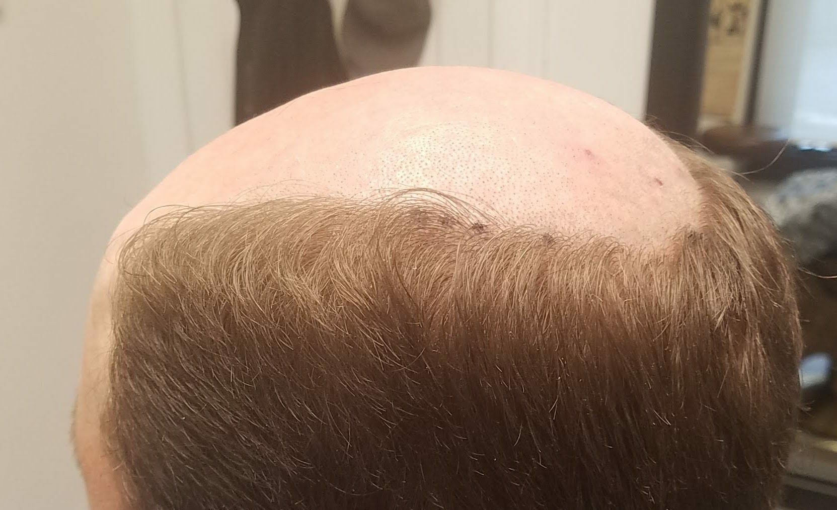 Man bald on the top side view